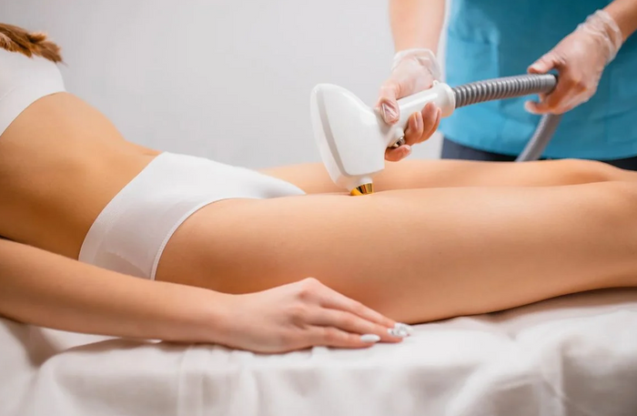DermaBloom Mirdif Dubai - Professional Full Body Laser Hair Removal