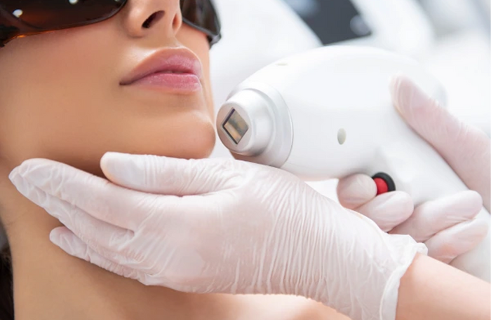 DermaBloom Mirdif Dubai - Professional Laser Hair Removal Treatments